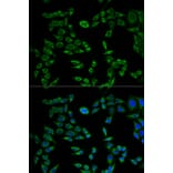 Immunofluorescence - VAPB Antibody from Signalway Antibody (32803) - Antibodies.com