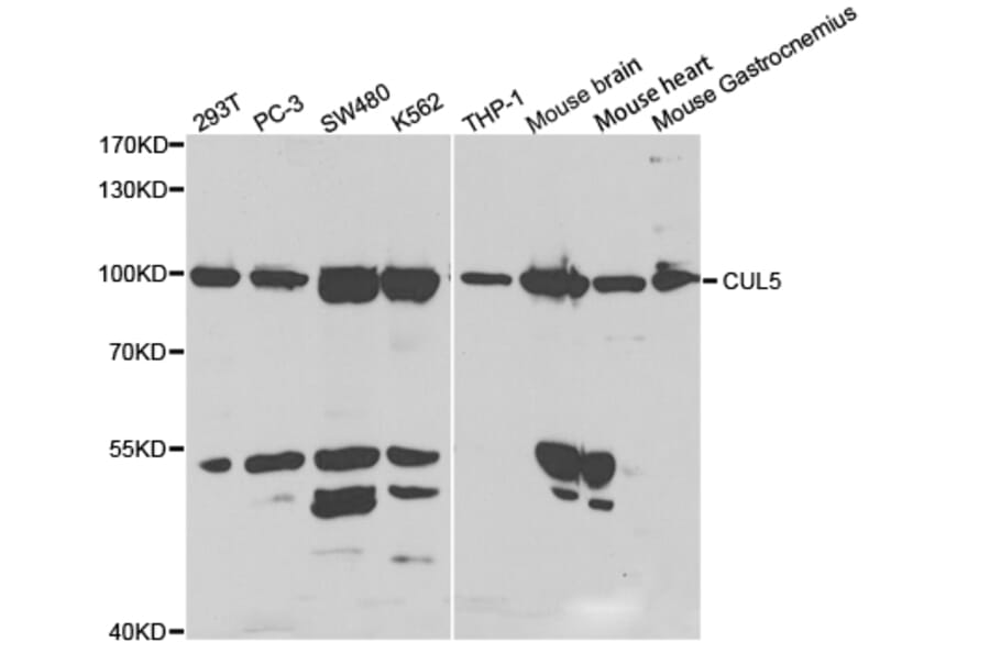 Western blot - CUL5 Antibody from Signalway Antibody (32809) - Antibodies.com