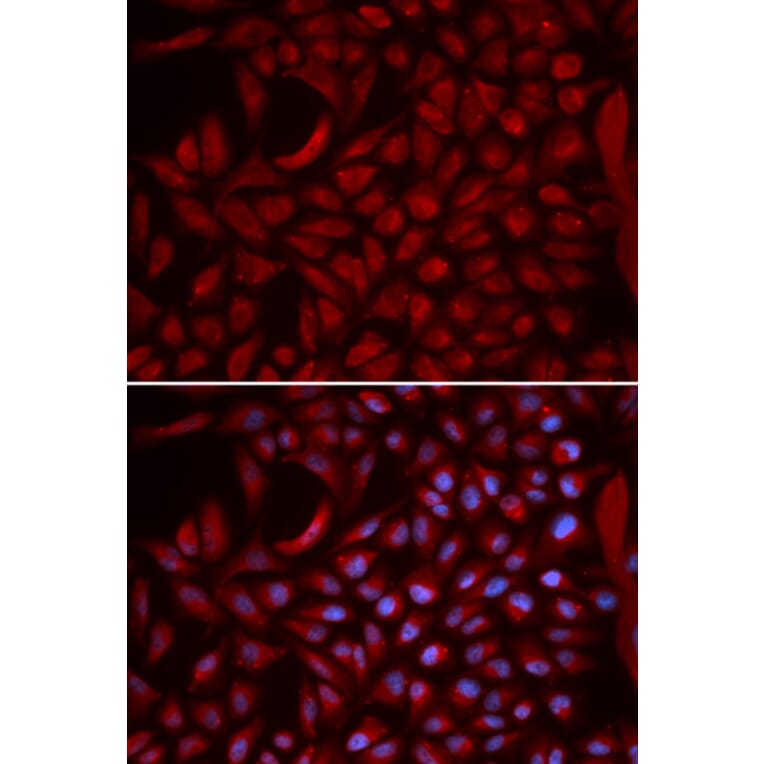 Immunofluorescence - CUL5 Antibody from Signalway Antibody (32809) - Antibodies.com