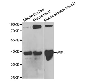 Western blot - WIF1 Antibody from Signalway Antibody (32820) - Antibodies.com