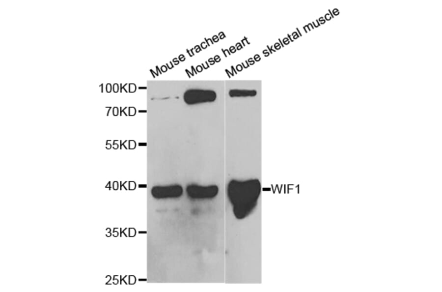Western blot - WIF1 Antibody from Signalway Antibody (32820) - Antibodies.com