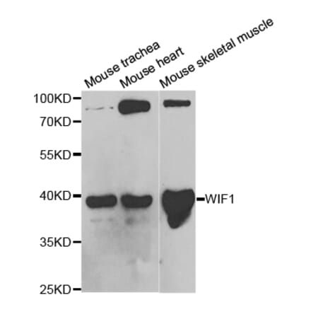 Western blot - WIF1 Antibody from Signalway Antibody (32820) - Antibodies.com