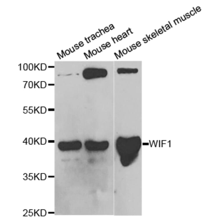 Western blot - WIF1 Antibody from Signalway Antibody (32820) - Antibodies.com