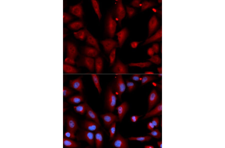 Immunofluorescence - WIF1 Antibody from Signalway Antibody (32820) - Antibodies.com