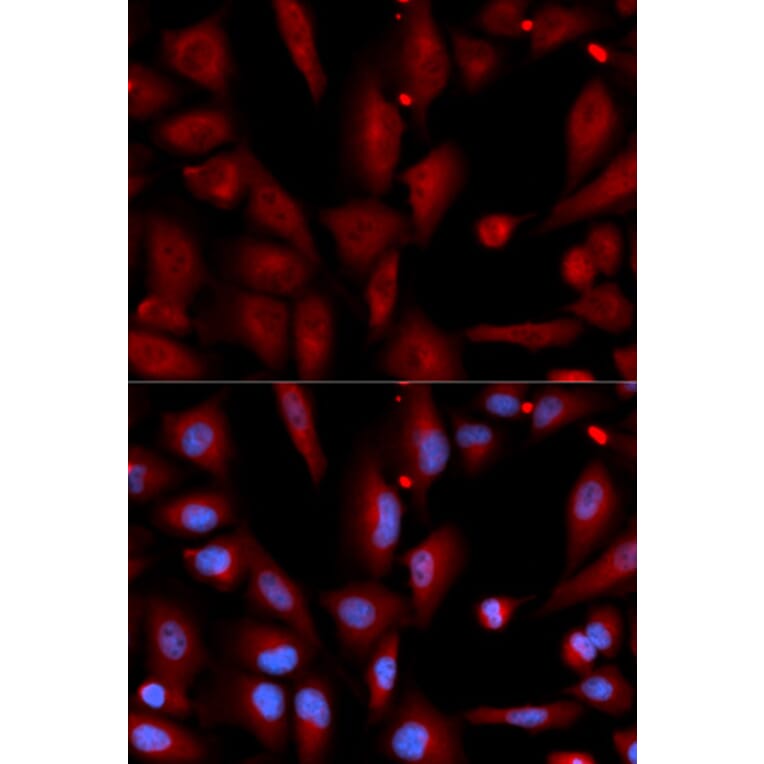 Immunofluorescence - WIF1 Antibody from Signalway Antibody (32820) - Antibodies.com