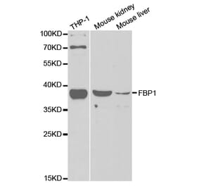 Western blot - FBP1 Antibody from Signalway Antibody (32834) - Antibodies.com