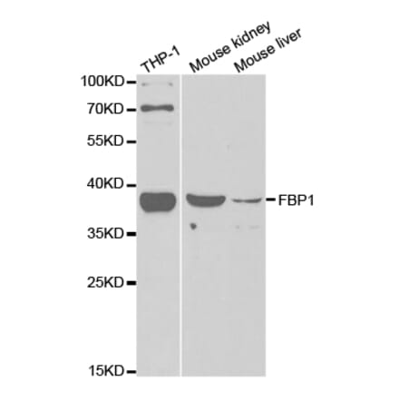 Western blot - FBP1 Antibody from Signalway Antibody (32834) - Antibodies.com