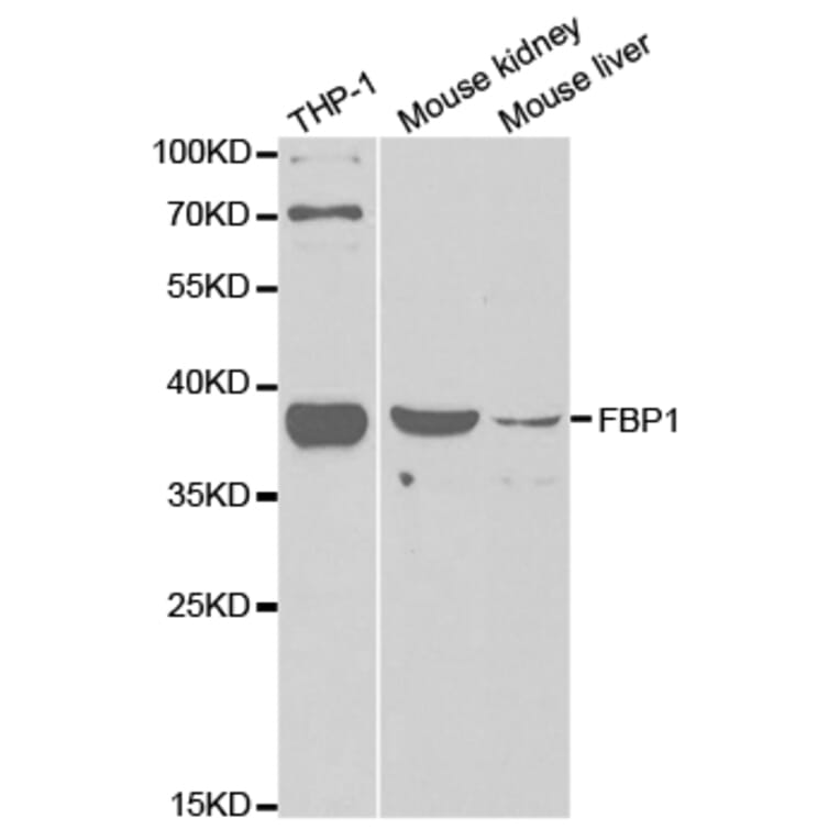 Western blot - FBP1 Antibody from Signalway Antibody (32834) - Antibodies.com