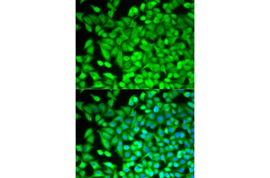 Immunofluorescence - FBP1 Antibody from Signalway Antibody (32834) - Antibodies.com