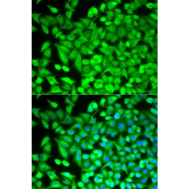 Immunofluorescence - FBP1 Antibody from Signalway Antibody (32834) - Antibodies.com