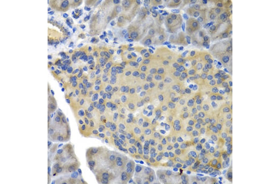Immunohistochemistry - FBP1 Antibody from Signalway Antibody (32834) - Antibodies.com