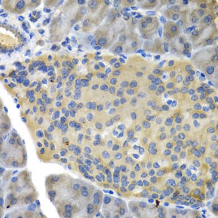 Immunohistochemistry - FBP1 Antibody from Signalway Antibody (32834) - Antibodies.com