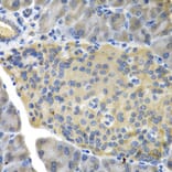 Immunohistochemistry - FBP1 Antibody from Signalway Antibody (32834) - Antibodies.com