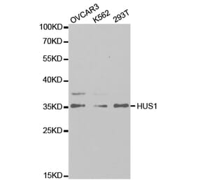 Western blot - HUS1 Antibody from Signalway Antibody (32835) - Antibodies.com