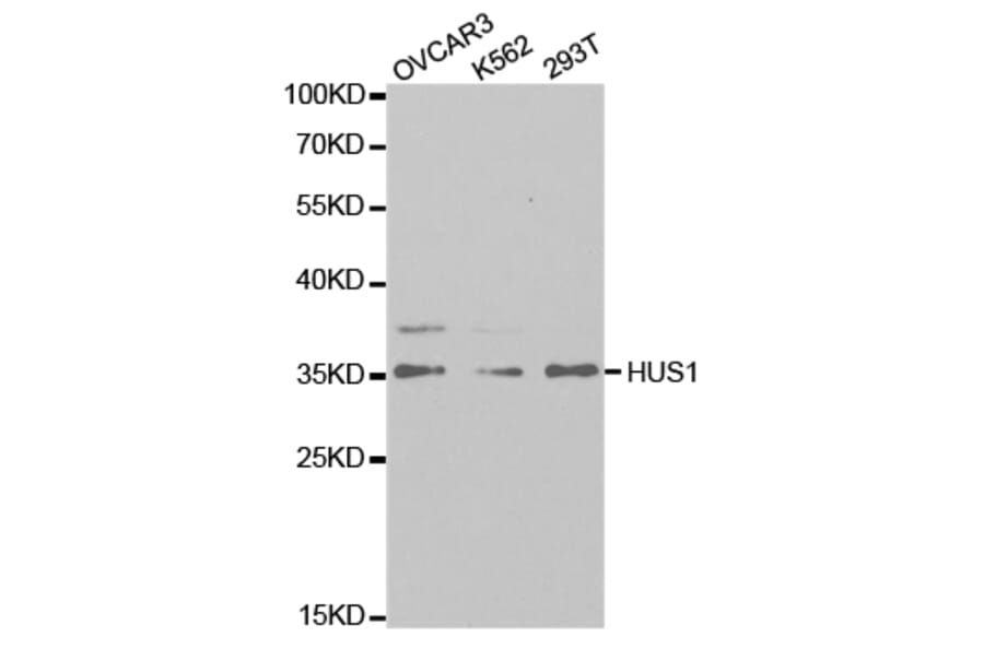 Western blot - HUS1 Antibody from Signalway Antibody (32835) - Antibodies.com