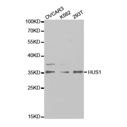 Western blot - HUS1 Antibody from Signalway Antibody (32835) - Antibodies.com