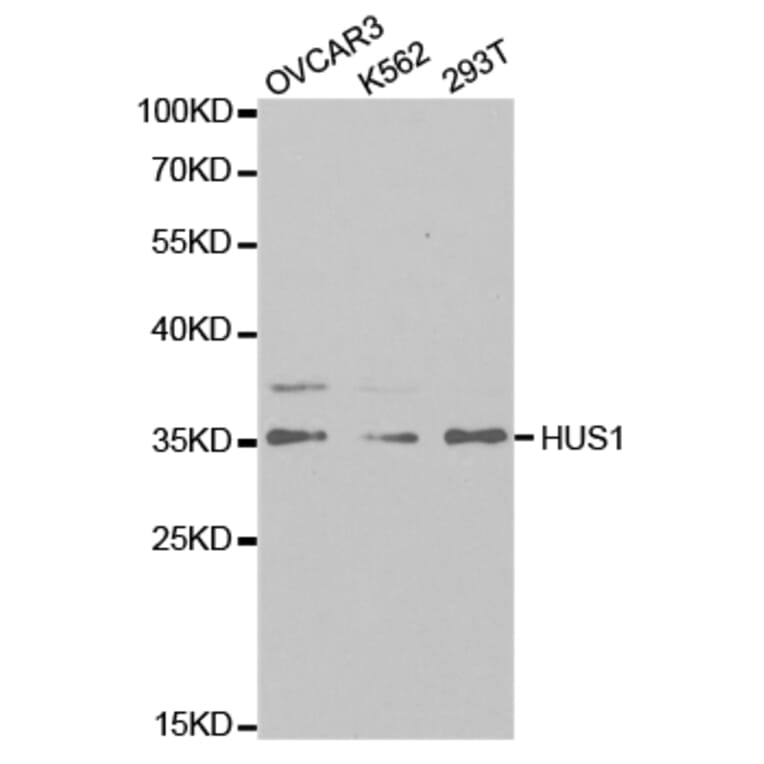 Western blot - HUS1 Antibody from Signalway Antibody (32835) - Antibodies.com