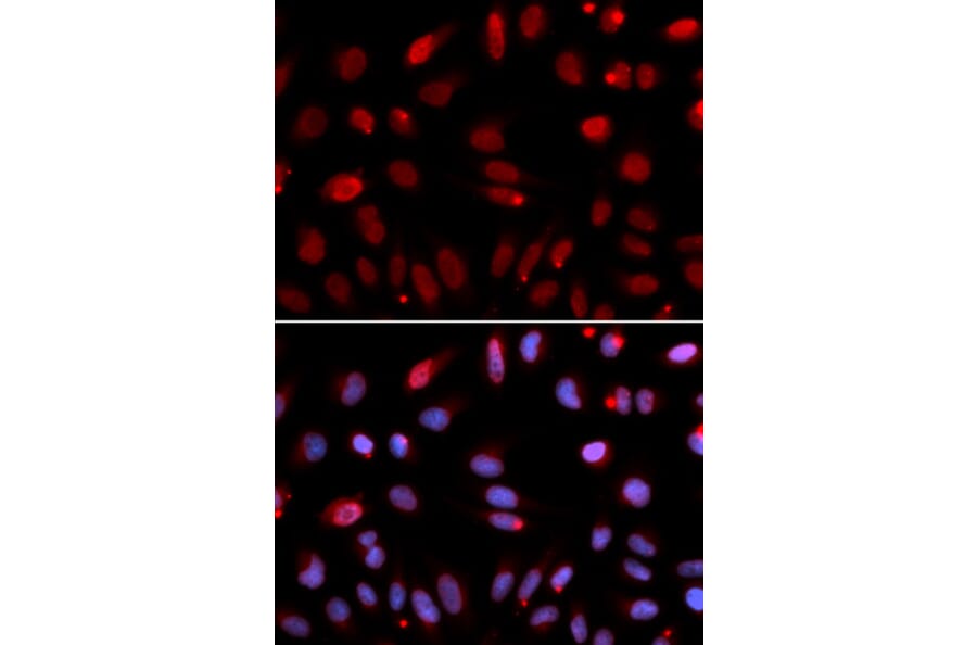 Immunofluorescence - HUS1 Antibody from Signalway Antibody (32835) - Antibodies.com