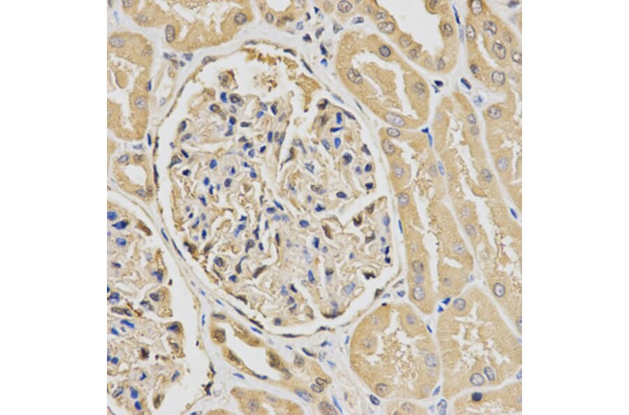 Immunohistochemistry - HUS1 Antibody from Signalway Antibody (32835) - Antibodies.com
