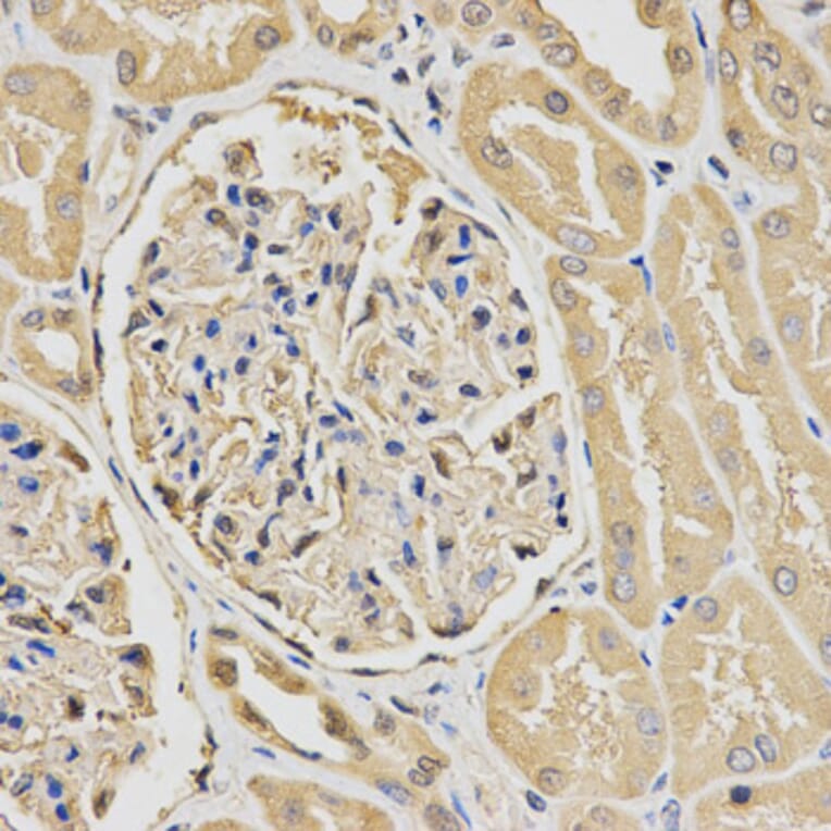 Immunohistochemistry - HUS1 Antibody from Signalway Antibody (32835) - Antibodies.com