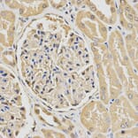 Immunohistochemistry - HUS1 Antibody from Signalway Antibody (32835) - Antibodies.com