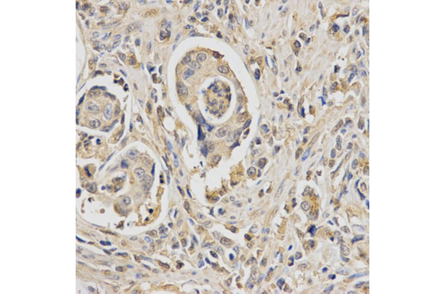 Immunohistochemistry - HUS1 Antibody from Signalway Antibody (32835) - Antibodies.com