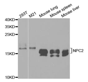 Western blot - NPC2 Antibody from Signalway Antibody (32840) - Antibodies.com