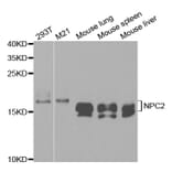 Western blot - NPC2 Antibody from Signalway Antibody (32840) - Antibodies.com