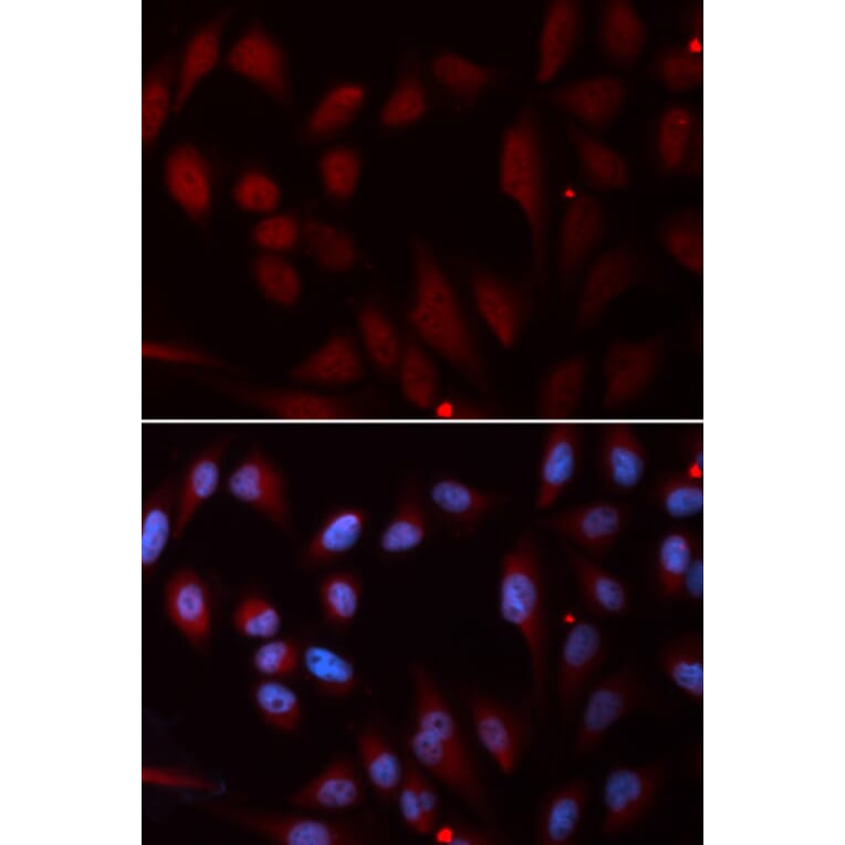 Immunofluorescence - NPC2 Antibody from Signalway Antibody (32840) - Antibodies.com