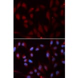 Immunofluorescence - NPC2 Antibody from Signalway Antibody (32840) - Antibodies.com