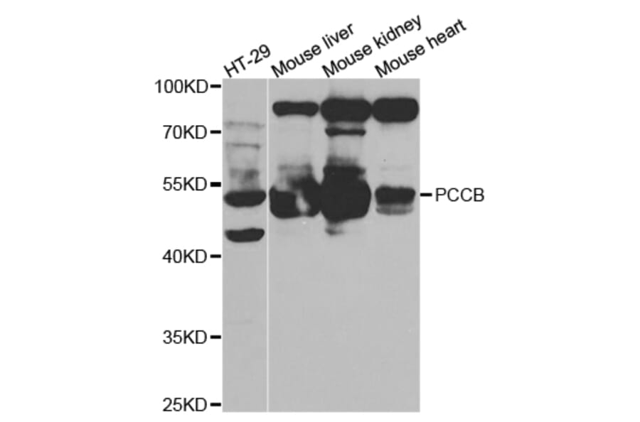Western blot - PCCB Antibody from Signalway Antibody (32841) - Antibodies.com