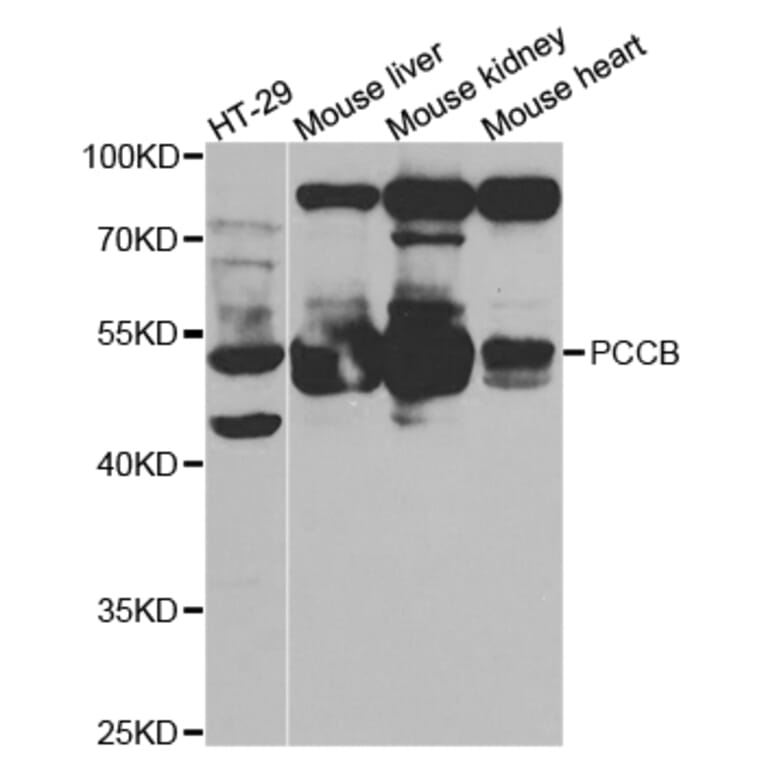 Western blot - PCCB Antibody from Signalway Antibody (32841) - Antibodies.com