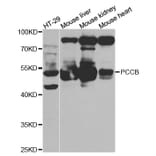 Western blot - PCCB Antibody from Signalway Antibody (32841) - Antibodies.com
