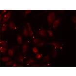 Immunofluorescence - PCCB Antibody from Signalway Antibody (32841) - Antibodies.com