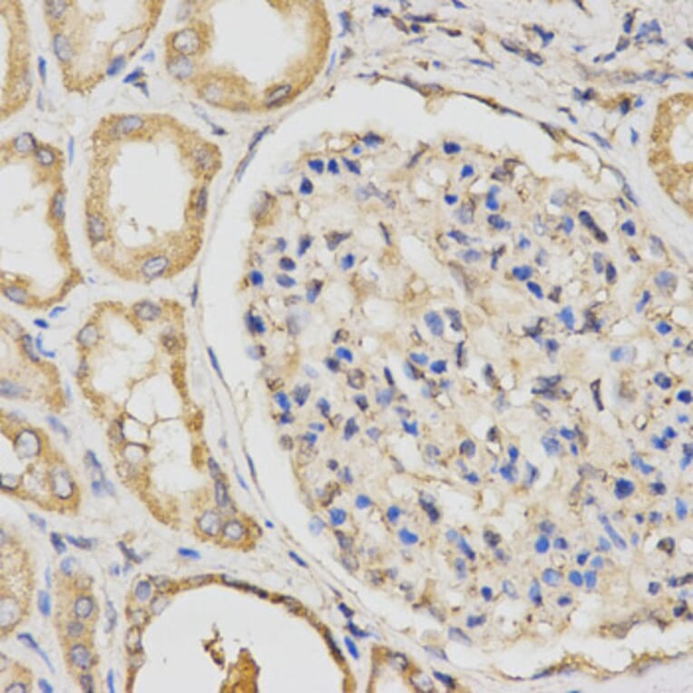 Immunohistochemistry - PCCB Antibody from Signalway Antibody (32841) - Antibodies.com