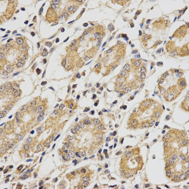 Immunohistochemistry - PCCB Antibody from Signalway Antibody (32841) - Antibodies.com