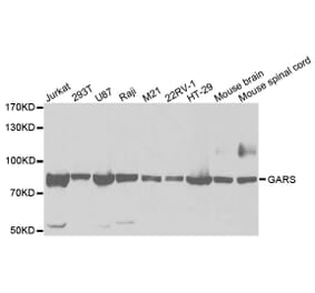 Western blot - GARS Antibody from Signalway Antibody (32847) - Antibodies.com