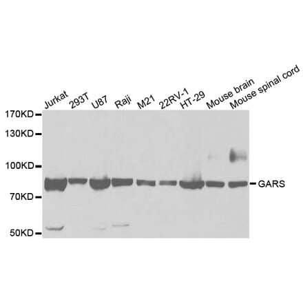 Western blot - GARS Antibody from Signalway Antibody (32847) - Antibodies.com