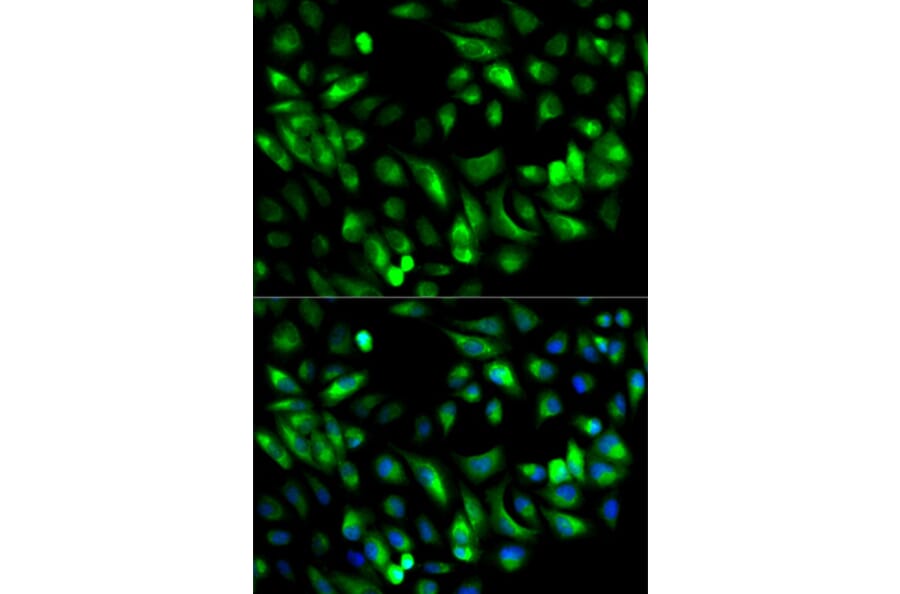 Immunofluorescence - GARS Antibody from Signalway Antibody (32847) - Antibodies.com