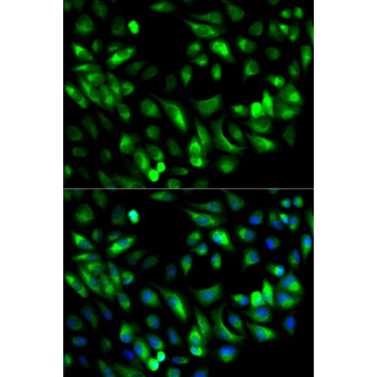 Immunofluorescence - GARS Antibody from Signalway Antibody (32847) - Antibodies.com
