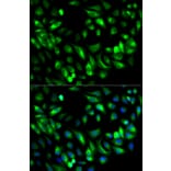 Immunofluorescence - GARS Antibody from Signalway Antibody (32847) - Antibodies.com