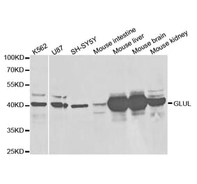 Western blot - GLUL Antibody from Signalway Antibody (32848) - Antibodies.com