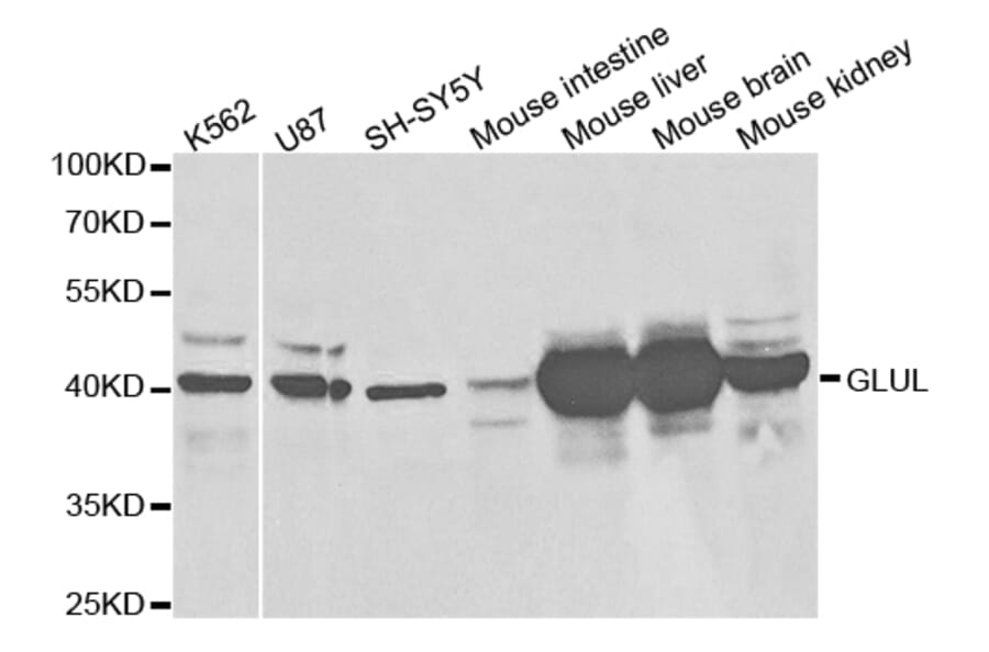 Western blot - GLUL Antibody from Signalway Antibody (32848) - Antibodies.com