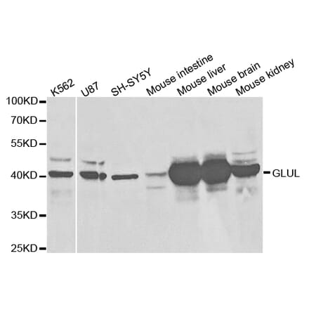 Western blot - GLUL Antibody from Signalway Antibody (32848) - Antibodies.com