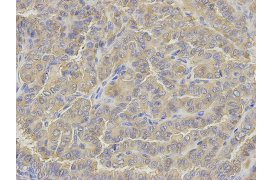 Immunohistochemistry - GLUL Antibody from Signalway Antibody (32848) - Antibodies.com