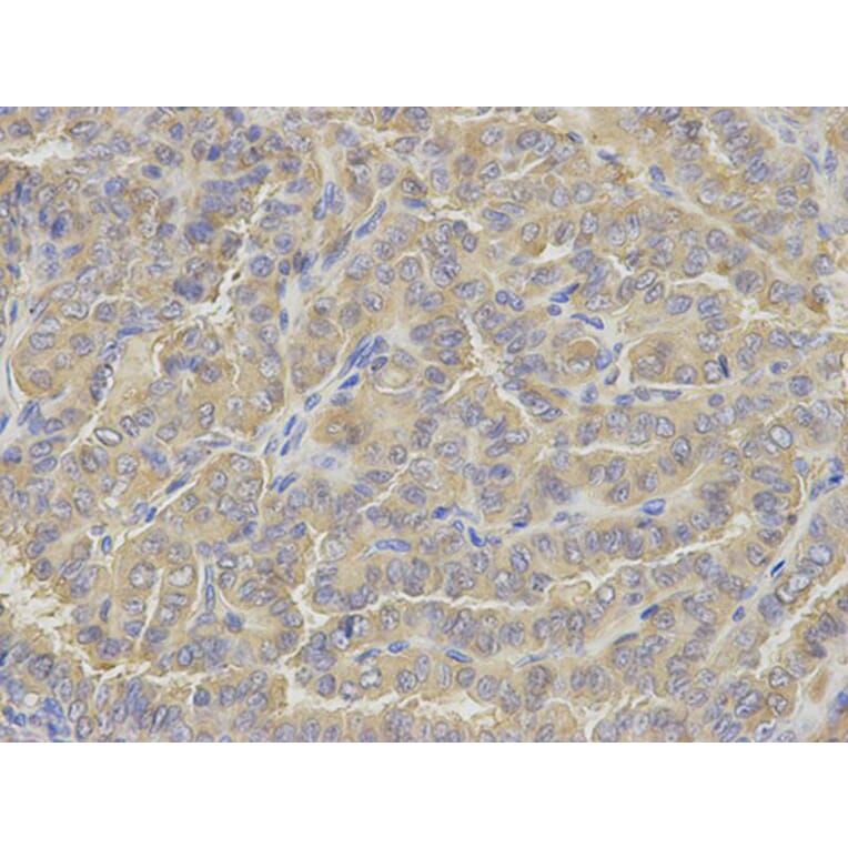 Immunohistochemistry - GLUL Antibody from Signalway Antibody (32848) - Antibodies.com