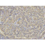 Immunohistochemistry - GLUL Antibody from Signalway Antibody (32848) - Antibodies.com