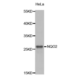 Western blot - NQO2 Antibody from Signalway Antibody (32849) - Antibodies.com