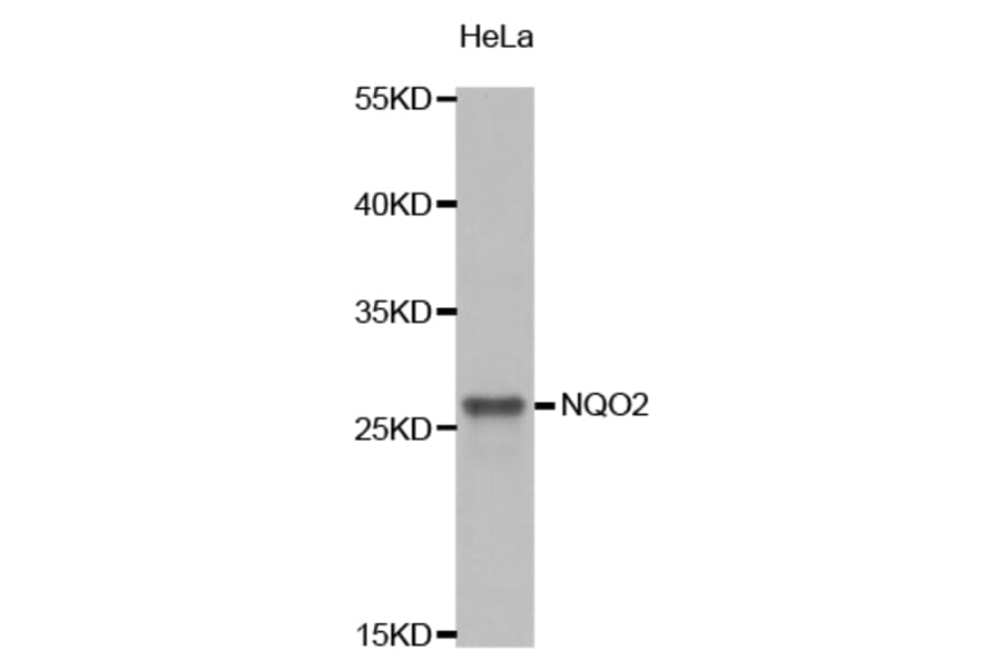 Western blot - NQO2 Antibody from Signalway Antibody (32849) - Antibodies.com