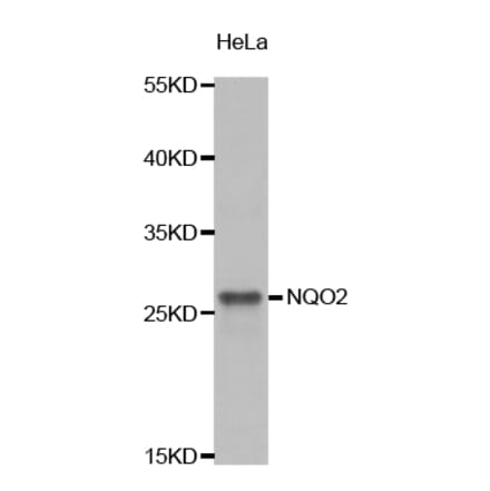 Western blot - NQO2 Antibody from Signalway Antibody (32849) - Antibodies.com
